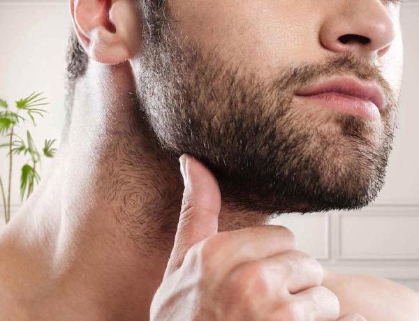  Beard transplant 